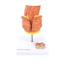3-21505-01-heinescientific-haemorrhoiden-modell.jpg