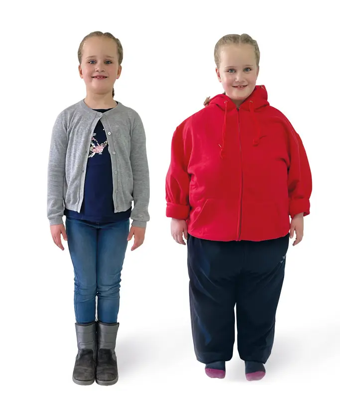 ERLERZIMMER Pat Junior Kinder Adipositas Trainer