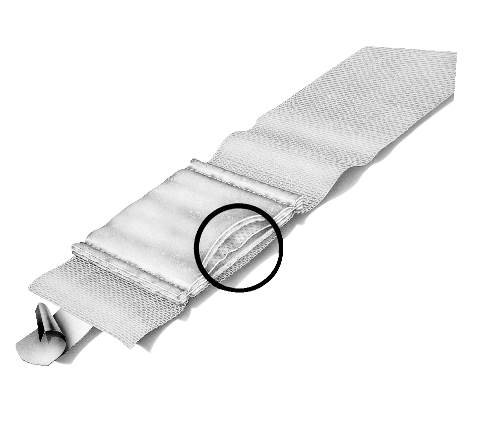 HOLTHAUS YPSELAST Schnellverband steril