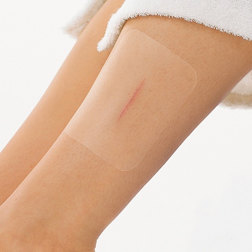 BSN Leukomed T Transparentverband, steril, 50 Stück