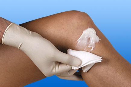 [15089-03] NOBA MK Gauze swabs 16 ply non-sterile