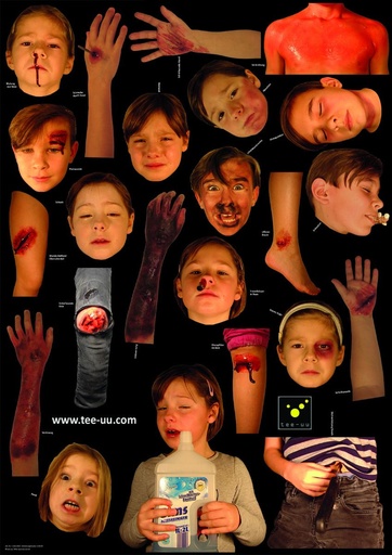 [21853-01] TEE-UU Injury pattern set 24-pcs. for Crash Junior training dummy