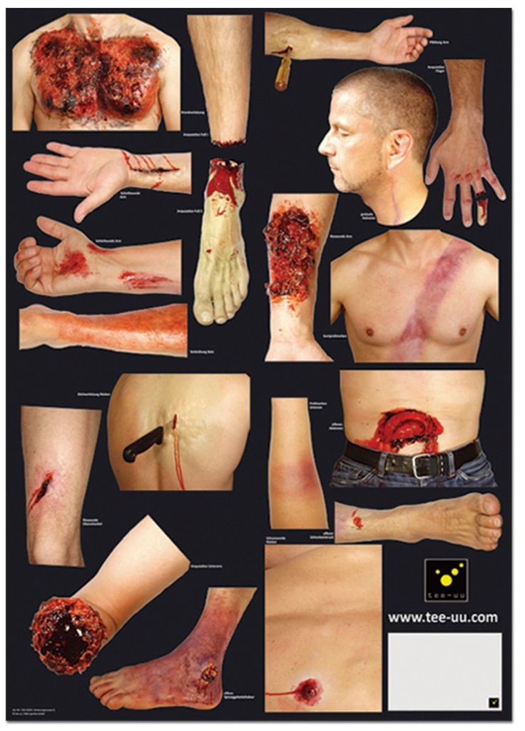 TEE-UU Injury pattern for training dummy