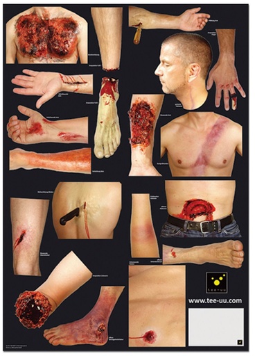 [25254-01] TEE-UU Injury pattern for training dummy