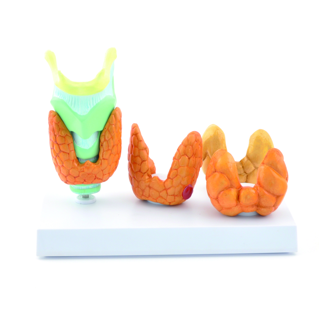 HEINESCIENTIFIC Anatomical model of thyroid diseases
