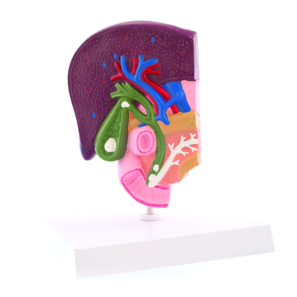 HEINESCIENTIFIC Anatomical model of the gallbladder with its diseases
