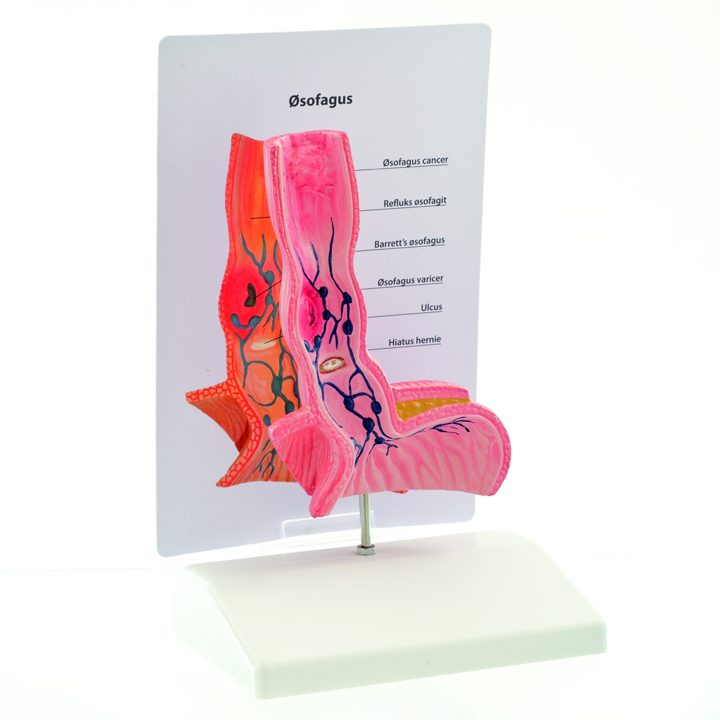 HEINESCIENTIFIC Anatomisches Modell einer menschlichen Speiseröhre