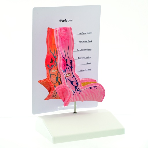 [14735-01] HEINESCIENTIFIC Anatomical model of a human esophagus