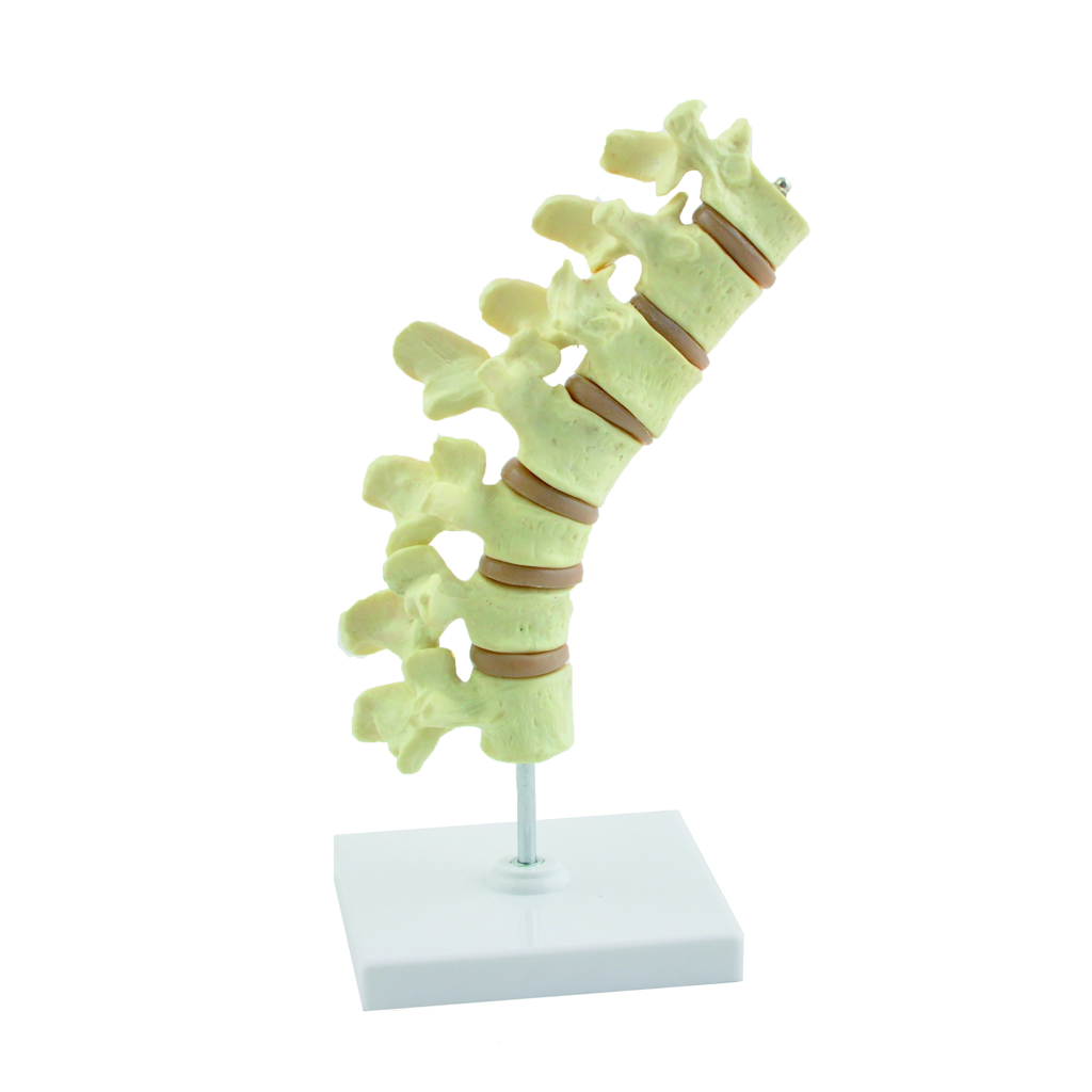 HEINESCIENTIFIC Osteoporosis model spine