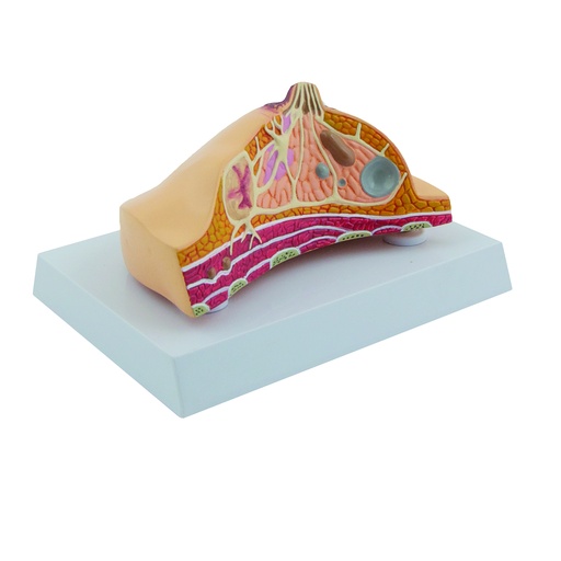 [14774-01] HEINESCIENTIFIC Breast model with typical diseases