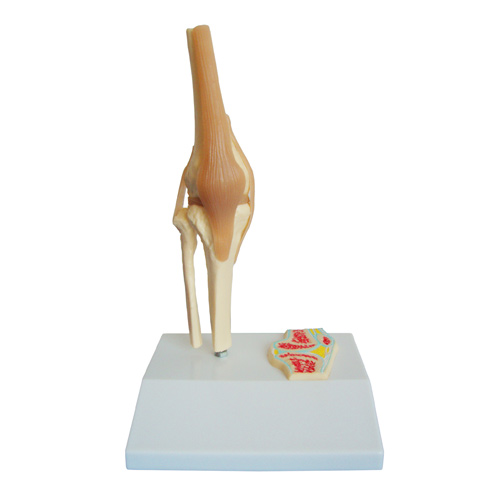 [14800-01] HEINESCIENTIFIC Knee model with small sagittal section model