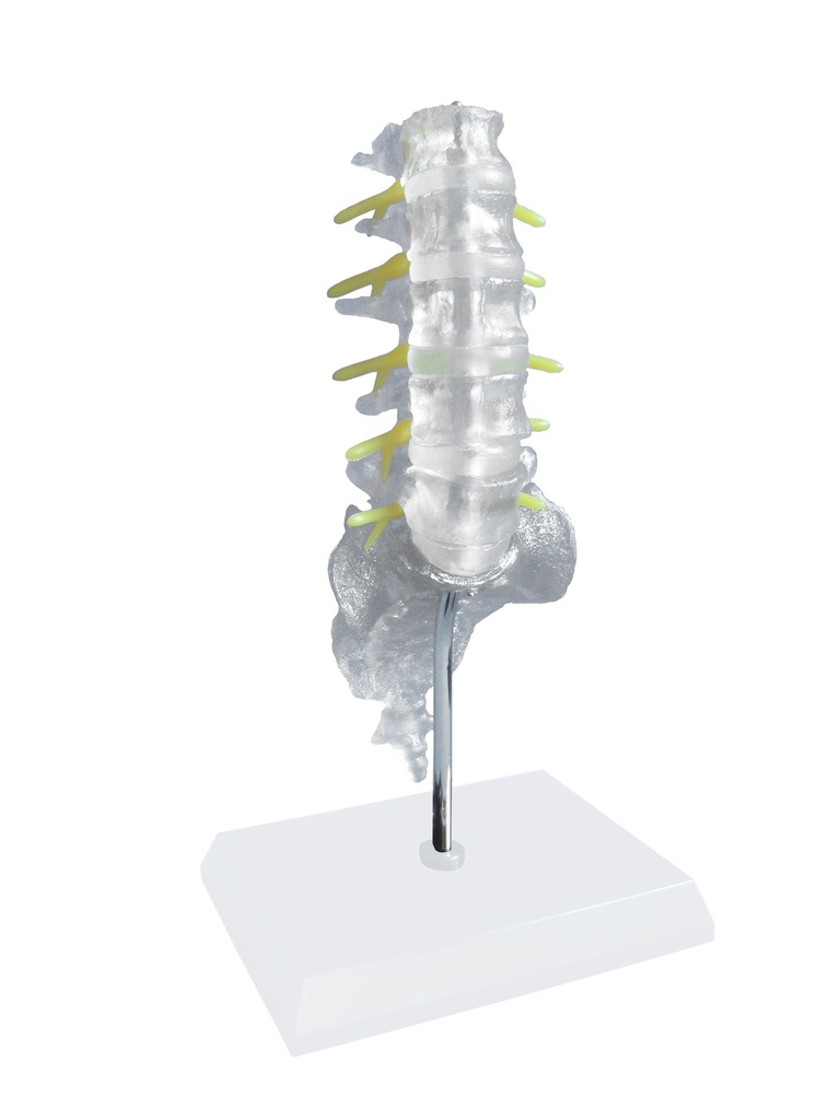 HEINESCIENTIFIC Modell der Lendenwirbelsäule in Lebensgröße transparent