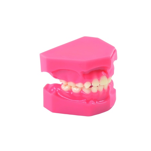 [14803-01] HEINESCIENTIFIC Model of tooth development, comparison 5/9 years