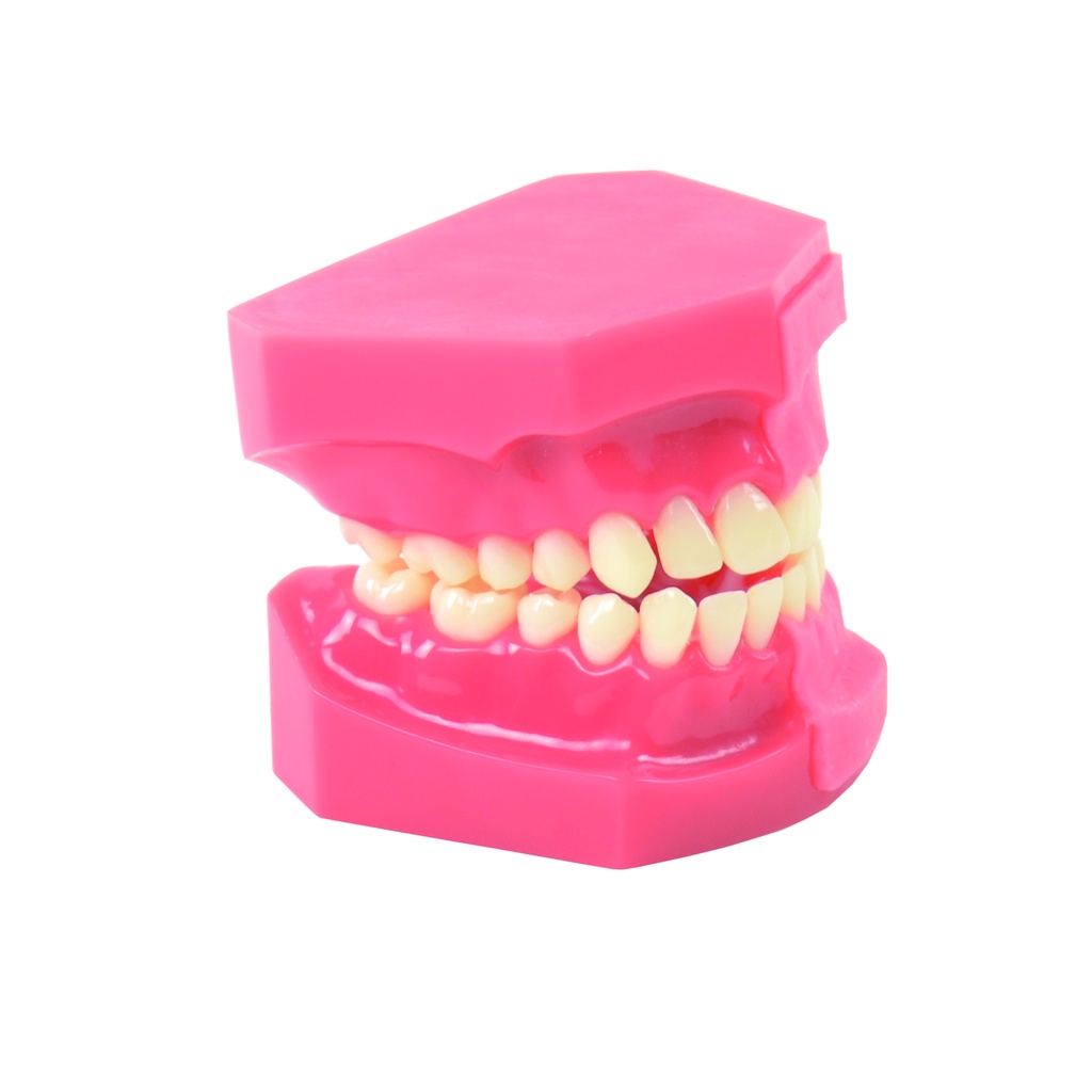 HEINESCIENTIFIC Model of tooth development, comparison 9/12 years