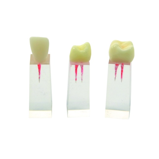 [14805-01] HEINESCIENTIFIC Tooth model set of molar, premolar and incisor