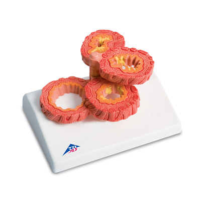 3B Scientific COPD Modell