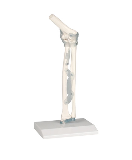 [20266-01] ERLERZIMMER Elbow Joint with Ligaments and Stand