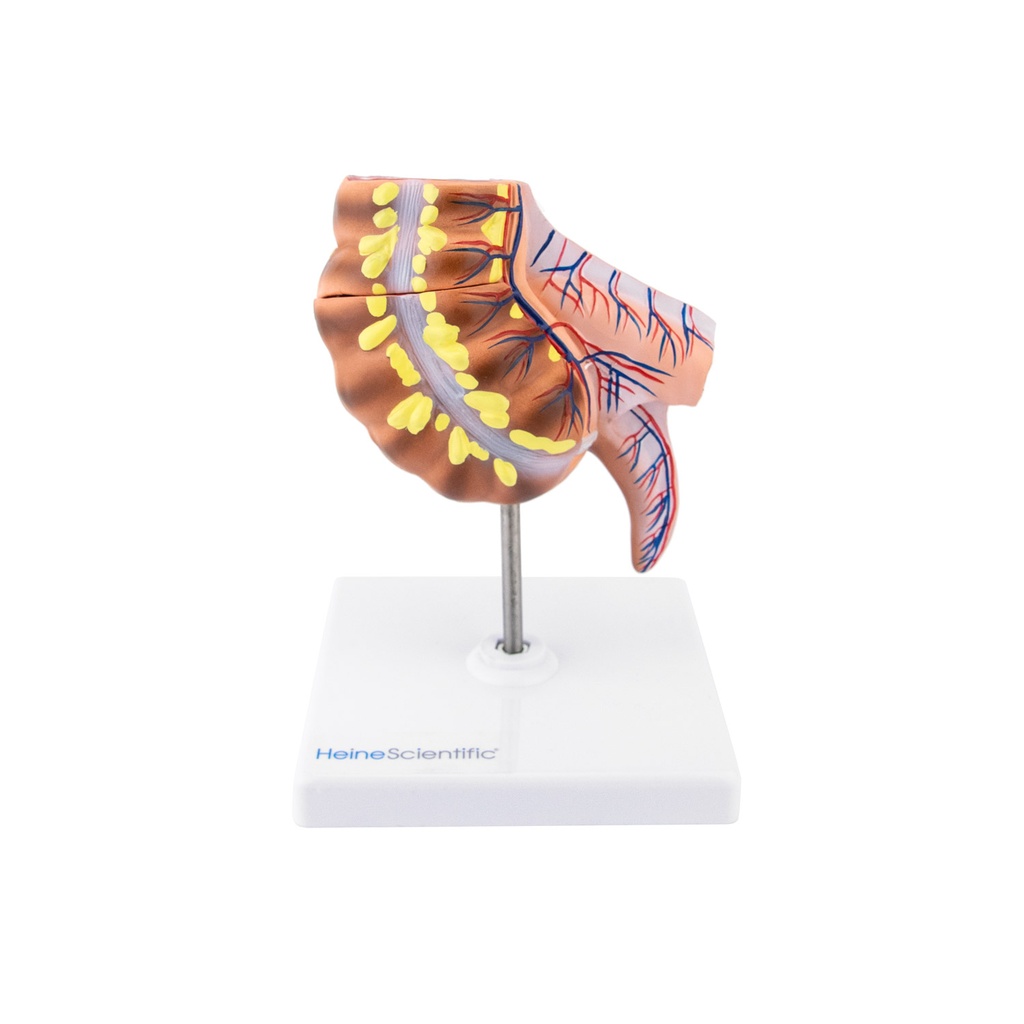 HEINESCIENTIFIC Appendix- und Caecum-Modell