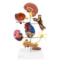 HEINESCIENTIFIC Model Diabetes complications
