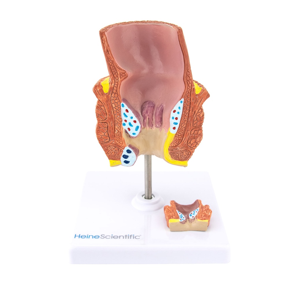 HEINESCIENTIFIC Hemorrhoid model