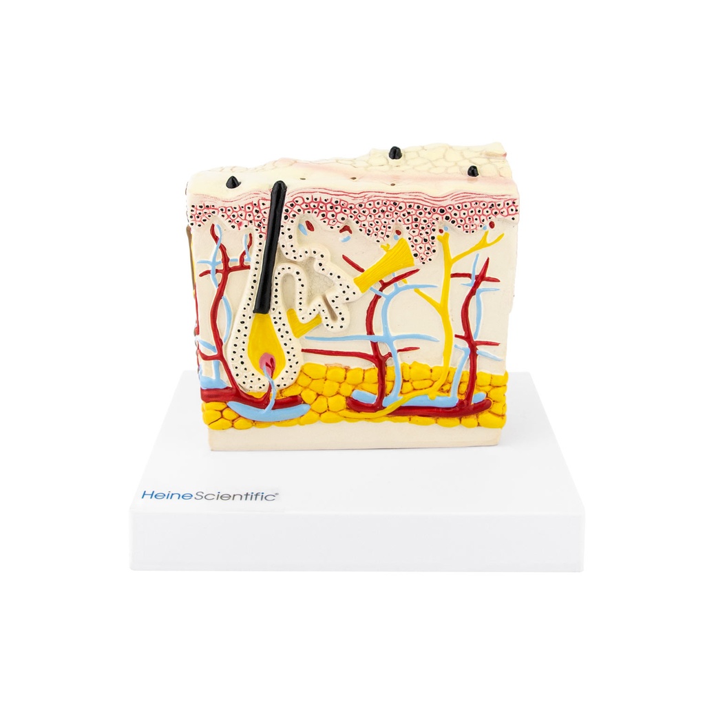 HEINESCIENTIFIC Skin model with psoriasis