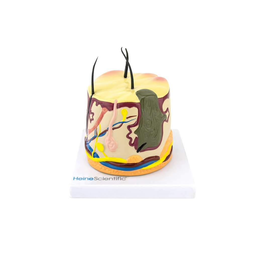 HEINESCIENTIFIC Skin model with acne