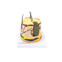 HEINESCIENTIFIC Skin model with acne