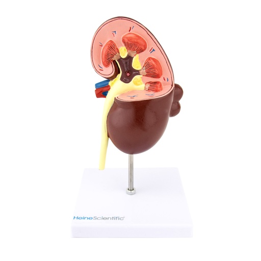 [21513-01] HEINESCIENTIFIC Model of a kidney with cysts