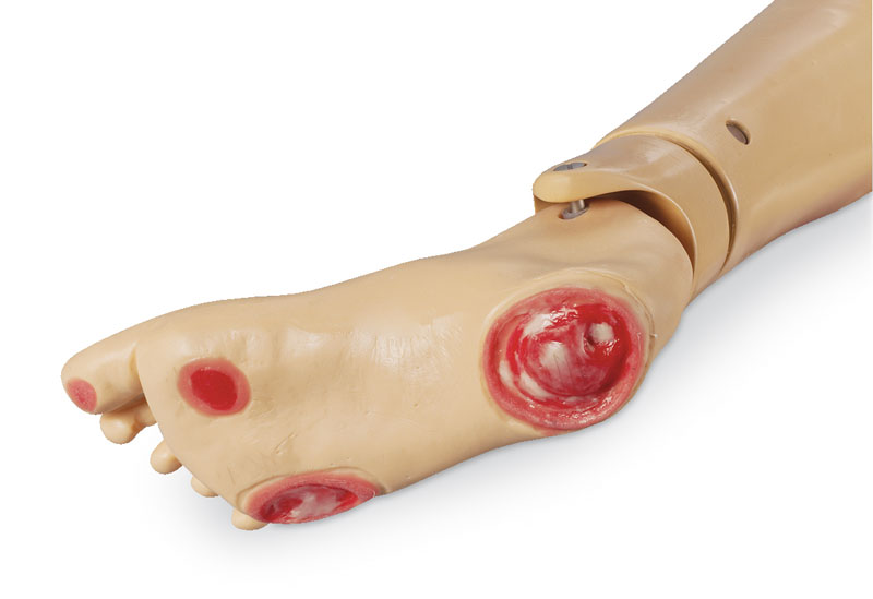 ERLERZIMMER Pressure Ulcer Foot for GERi and KERi