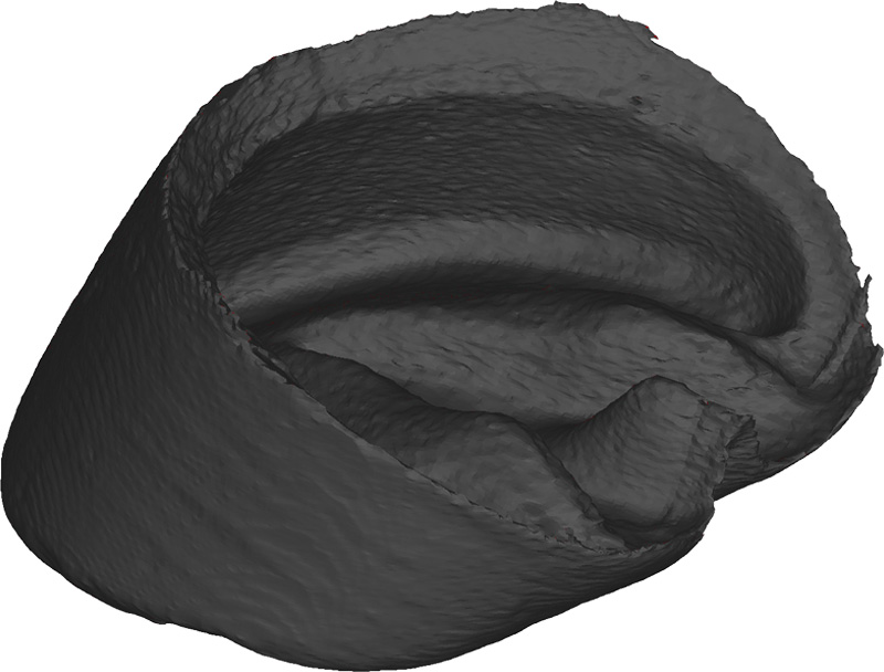 ERLERZIMMER Hornkapsel