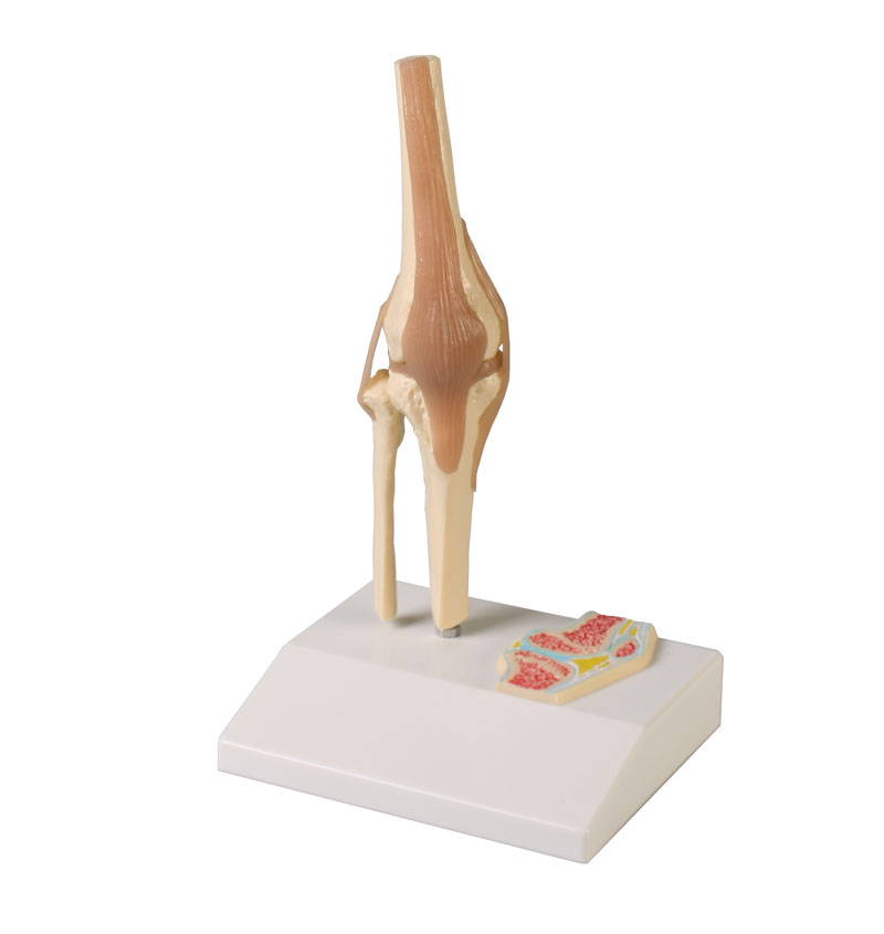 ERLERZIMMER Mini Knee Joint Model with Cross Section