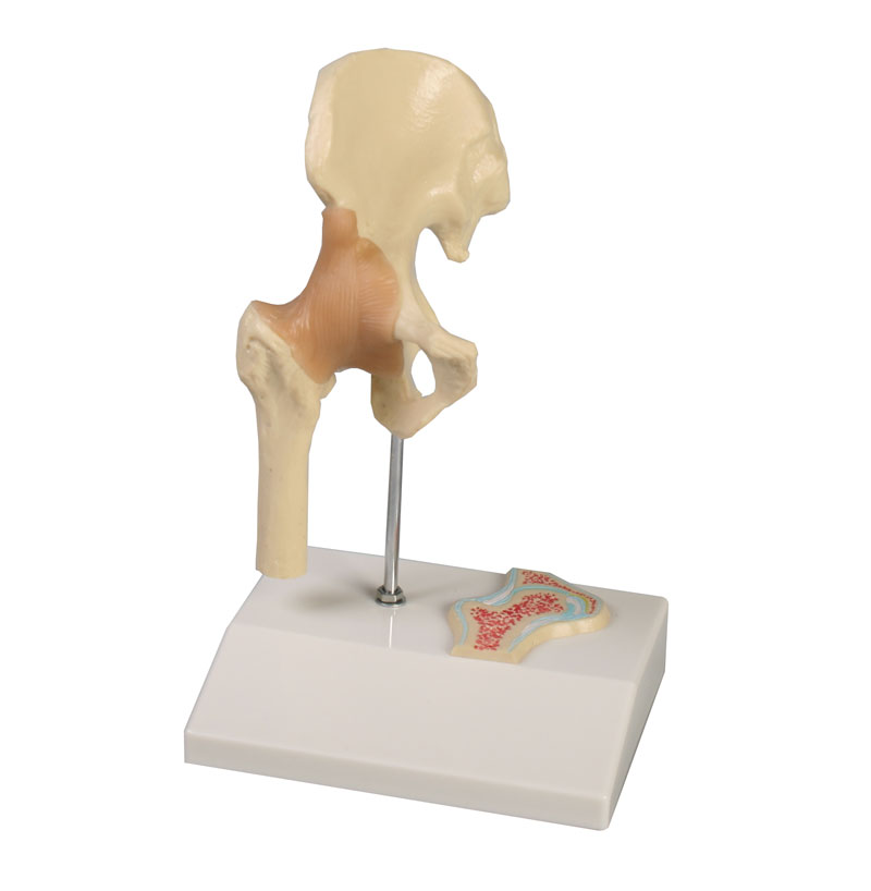 ERLERZIMMER Mini Hip Joint Model with Cross Section