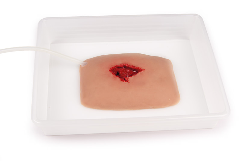 ERLERZIMMER Wujndmoulage wound packing