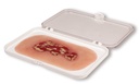 ERLERZIMMER Wound Moulage Venous Leg Ulcer small Exudation Phase