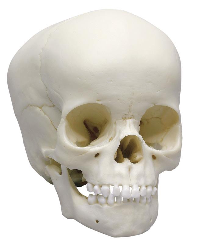 ERLERZIMMER Child Skull, 4 years old