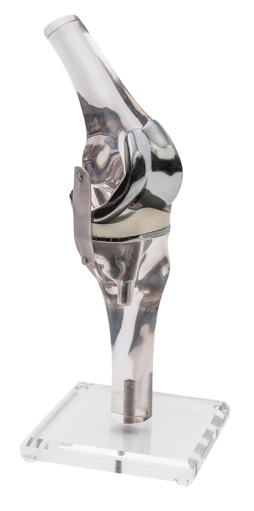 ERLERZIMMER Knee Model with Endoprosthesis