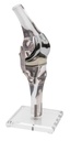 ERLERZIMMER Knee Model with Endoprosthesis