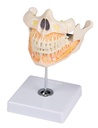 ERLERZIMMER Adult Dentition
