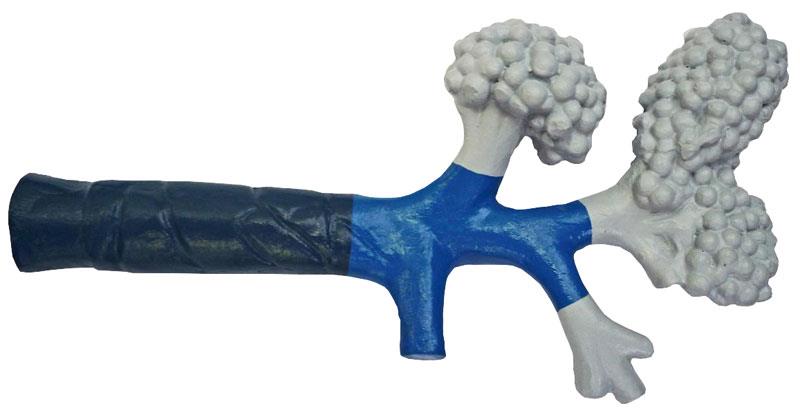 ERLERZIMMER Bronchiole