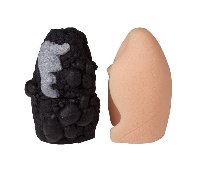 ERLERZIMMER Lung Cancer Comparison Model