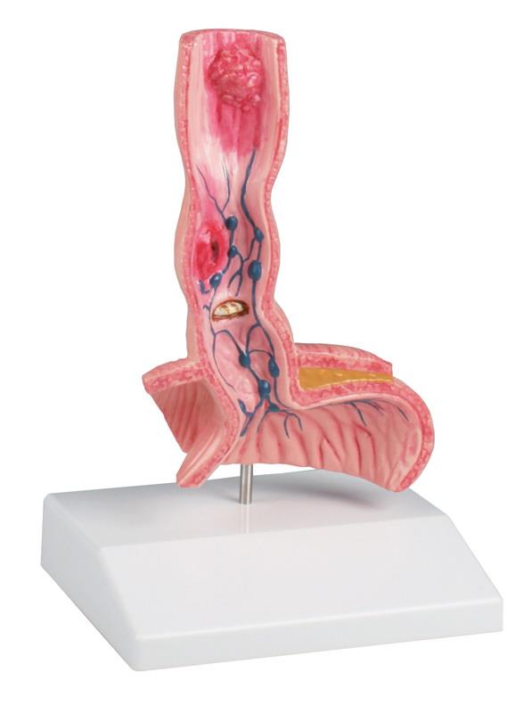 ERLERZIMMER Diseases of the Esophagus
