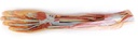ERLERZIMMER Forearm & Hand Superficial & Deep Dissection