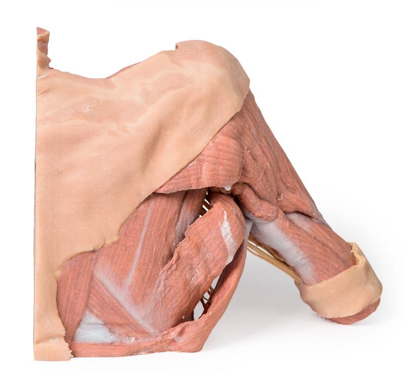 ERLERZIMMER Rechte Brustwandhälfte – Achsel und Halsansatz