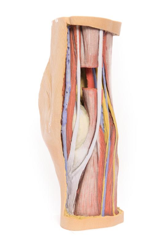ERLERZIMMER Popliteal fossa