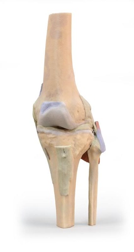 [24598-01] ERLERZIMMER Knee Joint, extended