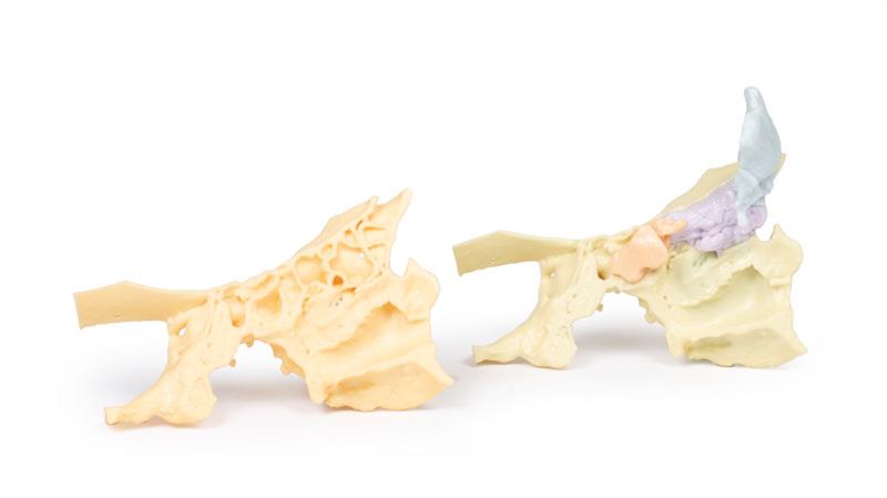 ERLERZIMMER Model of the Paranasal Sinuses