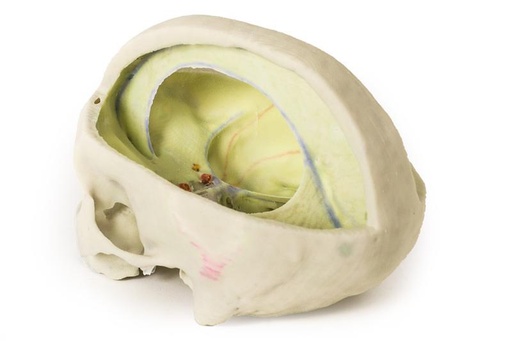 [24601-01] ERLERZIMMER Schädelmodell mit Ansatz der Dura mater