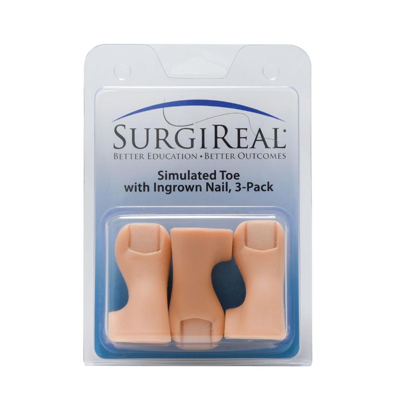 ERLERZIMMER Eingewachsener Zehennagelsimulator