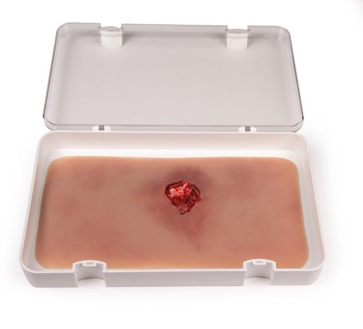 [24686-01] ERLERZIMMER Offener Bruch Arm mit Blutungsfunktion