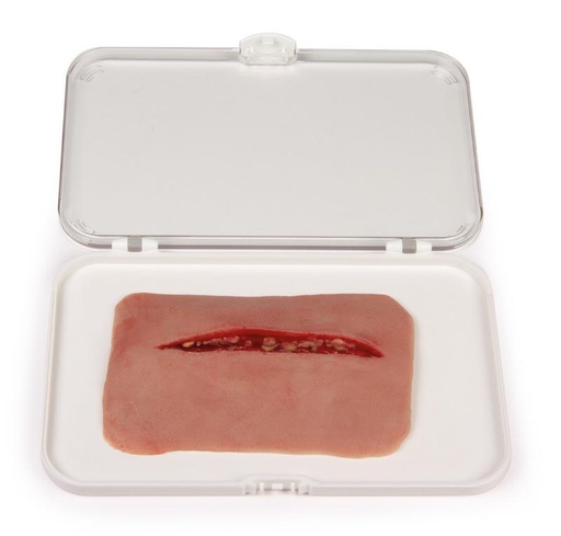 [24689-01] ERLERZIMMER Wundmoulage Schnittwunde